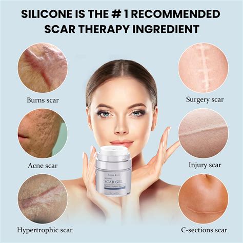 MONTE LUNA Scar Cream, Silicone Scar Gel – Scar Removal and Treatment ...