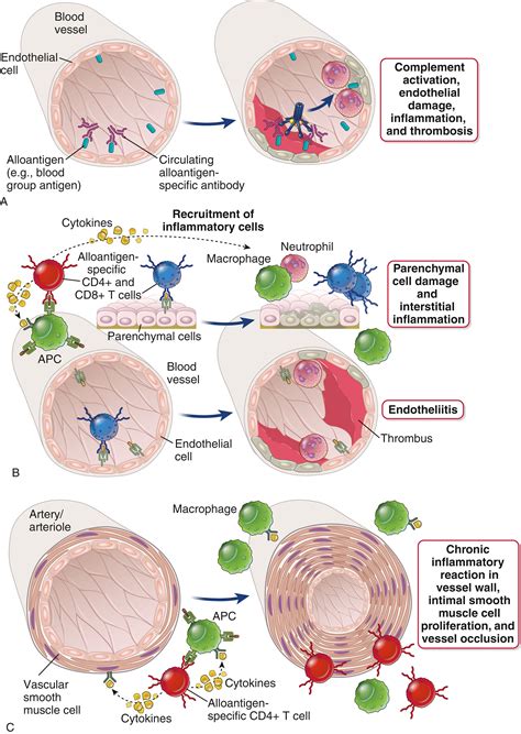 Transplantation Immunobiology and Immunosuppression - Clinical Tree