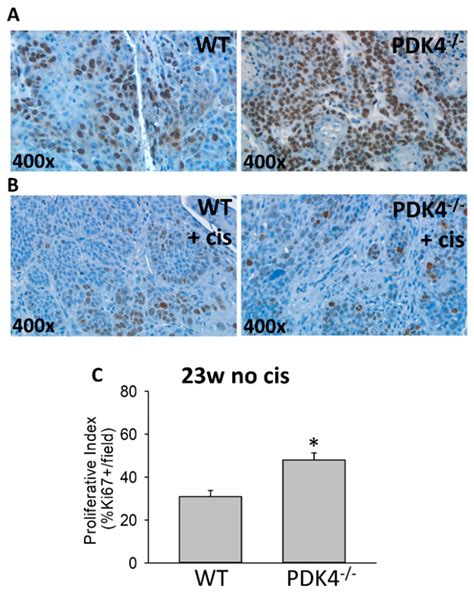 Pyruvate Dehydrogenase Kinase 4 Deficiency Increases Tumorigenesis in a ...