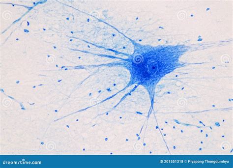 Motor Neuron Under the Microscope. Stock Photo - Image of micrograph ...