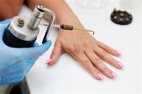 Freezing Spots At Home Vs. At The Dermatologist: What's The Difference?