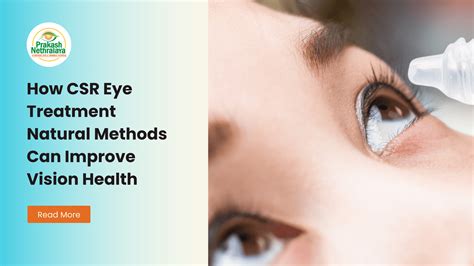 Natural CSR Eye Treatment – Vision Health Tips