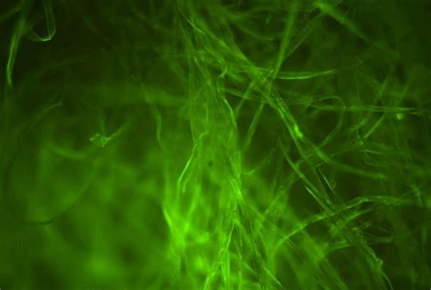 New Collaborative Study by Ritesh Shukla Uses Fluorescent Dye for Blood ...