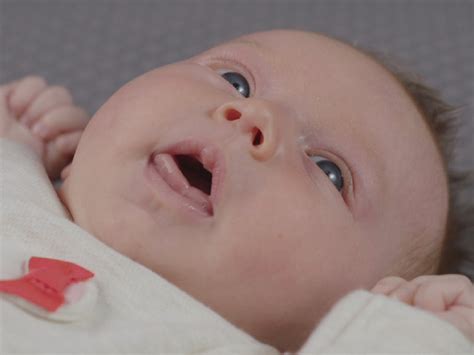 Plagiocephaly (flat head syndrome) | BabyCenter