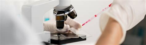 Hematology Tests - Jind Lab