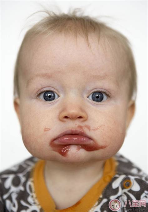 为什么幼儿嘴巴会破洞破皮 如何治疗宝宝嘴巴破皮 _八宝网