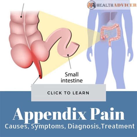 Image result for Appendix Example Website