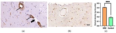 Neuroinflammatory Dysfunction of the Blood–Brain Barrier and Basement ...