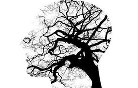 Sublingual dexmedetomidine beneficial against severe agitation in ...