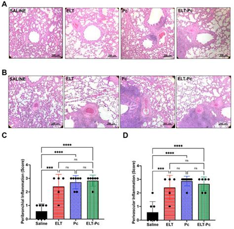 Pneumocystis Exacerbates Inflammation and Mucus Hypersecretion in a ...