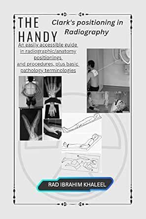 The Handy Clark's positioning in Radiography: An easily accessible ...