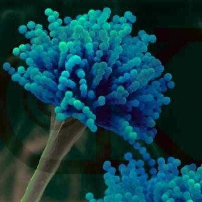 【地球生物全系列——从单细胞到人类】真菌界—子囊菌门 - 知乎
