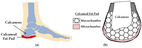 Mechanical Modeling of Healthy and Diseased Calcaneal Fat Pad Surrogates