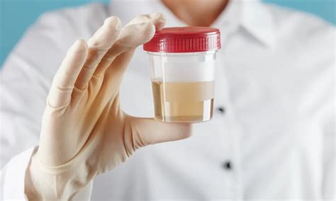 Degree of pyuria alone doesn't predict UTI