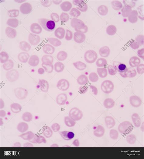Nucleated Red Blood Cells