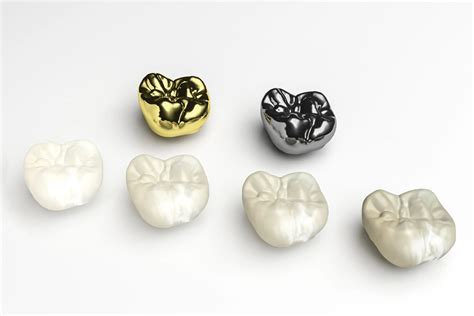 Different Types of Dental Crowns: Pros and Cons - disadvantages of dental crowns