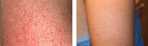 Calming Anti Itch Lotion (100ml) – Oleum Cottage