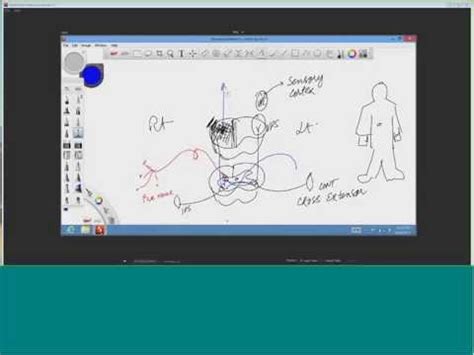Live lecture recording - CNS for USMLE Step 1 Ascending Tracts of ...
