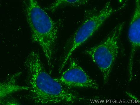 LETM1 antibody (CL488-68208) | Proteintech