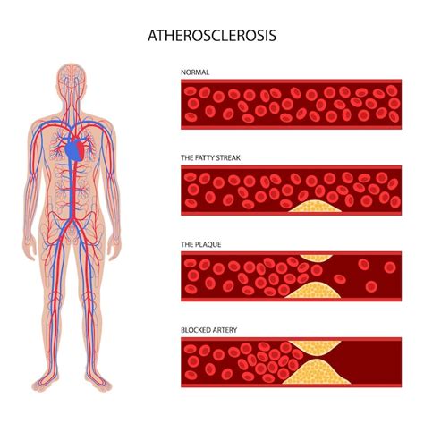Page 24 | Arterial roads Images - Free Download on Freepik