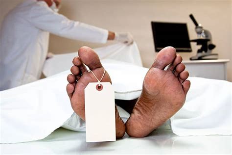Autopsy Rates Differ Among Black, White Patients | MedPage Today