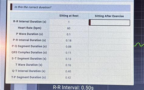 Solved Is this the correct duration?table[[R-R Interval | Chegg.com
