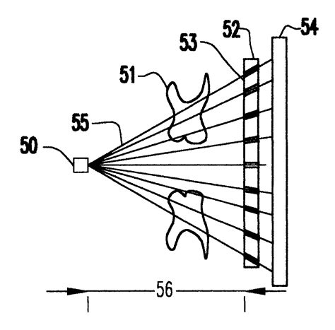 Image result for Transillumination