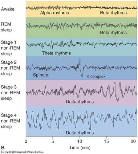 Sleep 的图像结果