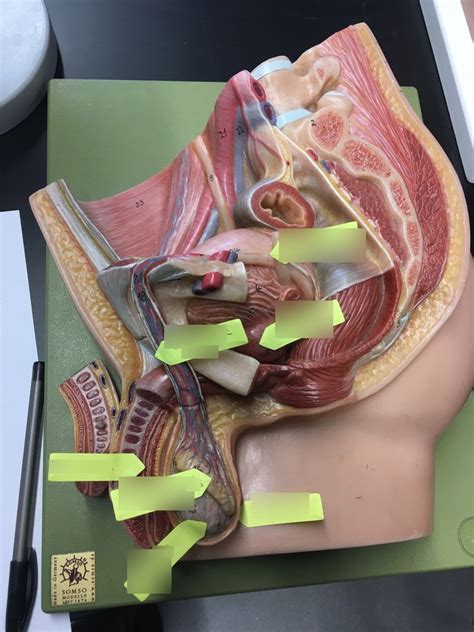 Image result for Male Reproductive Model Label