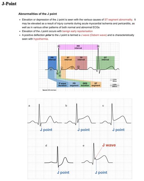 What Causes J Point Elevation