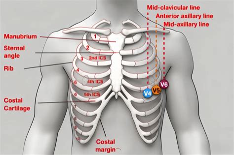 3 Lead ECG Placement: Fast, Clean, Step-by-Step | MedLinket