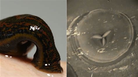 WATCH: See How Leeches Can Be A Surgeon's Sidekick - WOUB Public Media