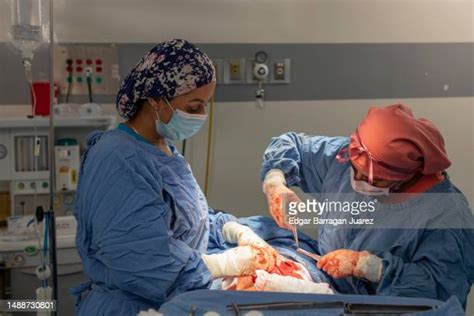 C-Section Wound 的图像结果