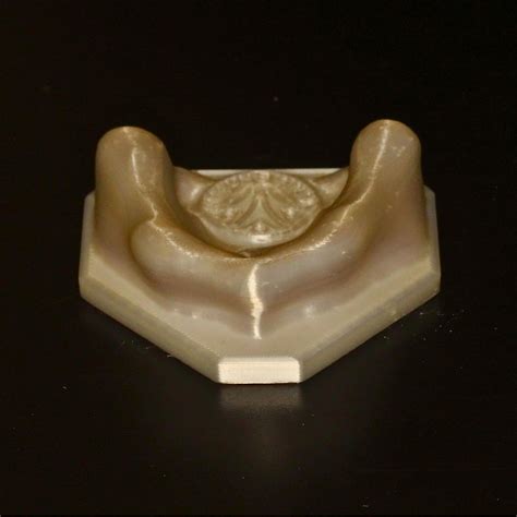 Completely Edentulous Maxilla | V-Invent