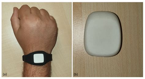 Analysis and Classification of Motor Dysfunctions in Arm Swing in ...