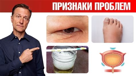 Заболевания почек