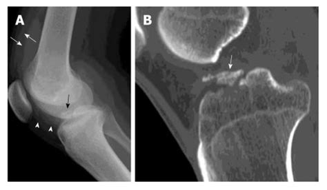 Physiocure | The sports Rehab clinic.