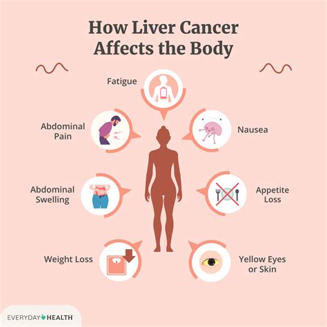 Understand The Causes And Symptoms Of Liver Cancer Dr