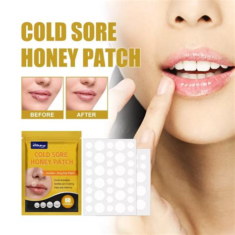 Abreva Conceal Cold Sore Patch