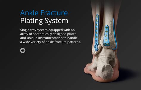 Implant Systems - Unite Foot and Ankle | Development site