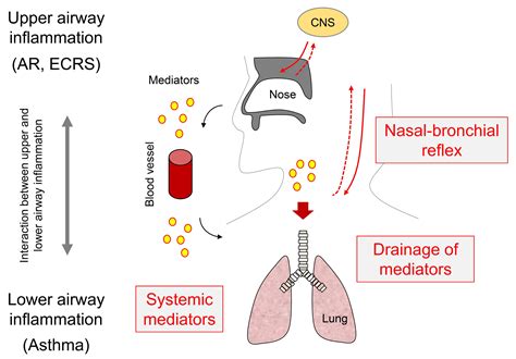 Regulation of Interaction Between the Upper and Lower Airways in United ...