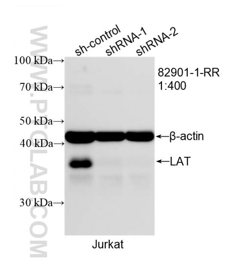 LAT antibody (82901-1-RR) | Proteintech