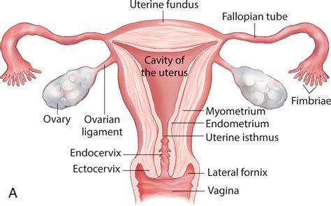 Pathology of the Ovaries - Clinical Tree