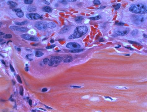 Suraksha Diagnostics: Complete Pathology and Radiology Services ...