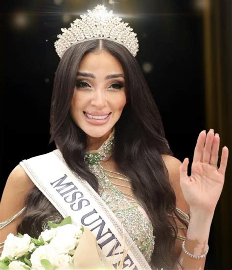 Mujer con vitiligo es coronada Miss Universe Egipto - Primera Hora