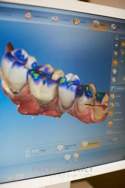 Image result for Teeth Computer