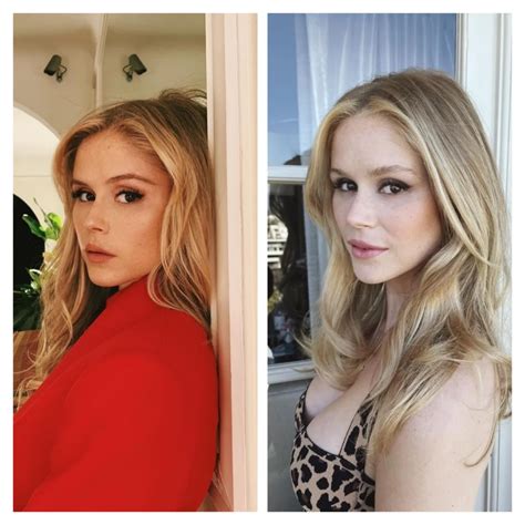 Erin Moriarty Plastic Surgery: Truth Behind the Transformation