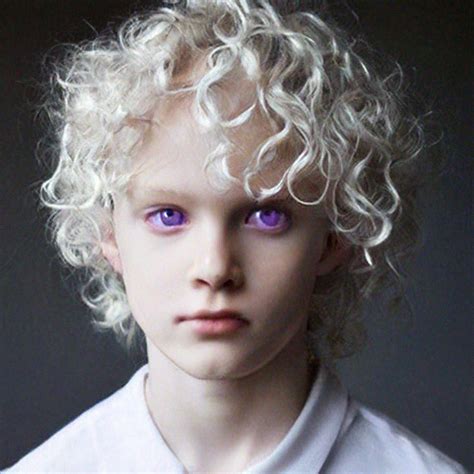Albino People With Purple Eyes Albino Girl, Purple Eyes,