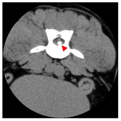 A Comparative Analysis of Clinical Presentation, Prognosis and Outcomes ...