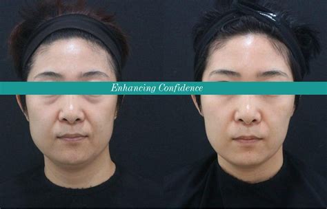 Image result for Face Threads